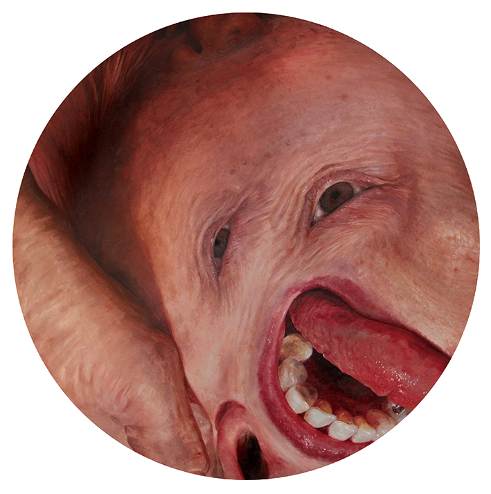 horacio-quiroz-anger-unde-depression